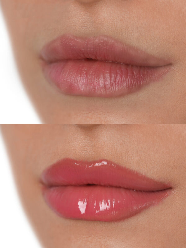 Lip Blush Neutralization